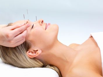 5 health conditions helped by acupuncture
