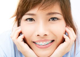 Are braces, crowns or veneers right for you?