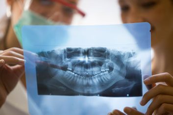 dentalxray