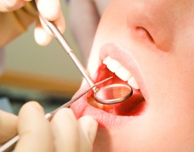 dentist teeth exam