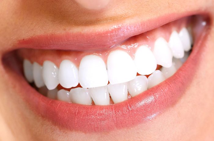 adult-orthodontics-straight-teeth