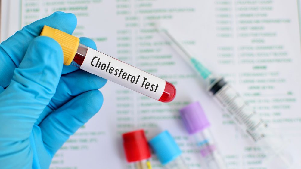 blood cholesterol blood lab sample