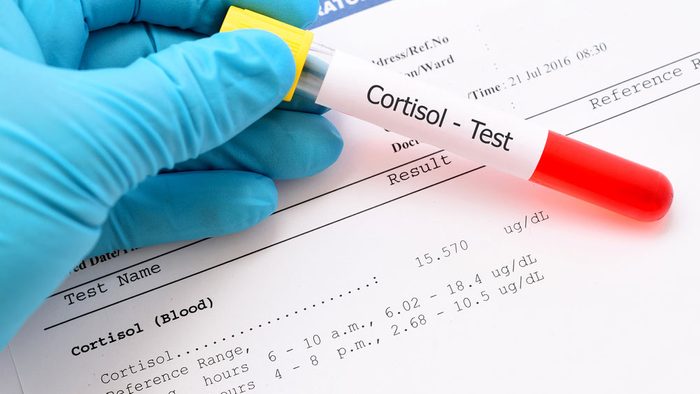 blood cortisola lab sample