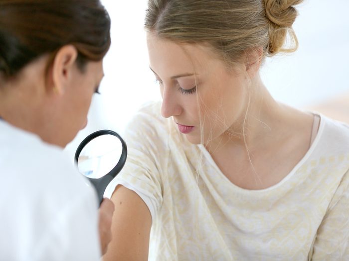 noticeable-skin-changes_cancer symptoms women ignore 