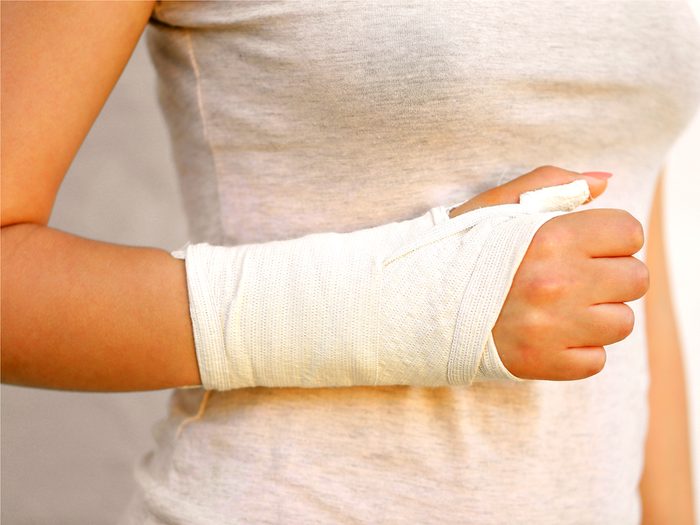 Breaking a bone in a seemingly minor accident is a sign you’re not getting enough calcium