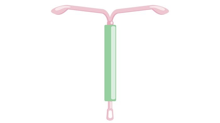 Why am I spotting IUD IUS illustration