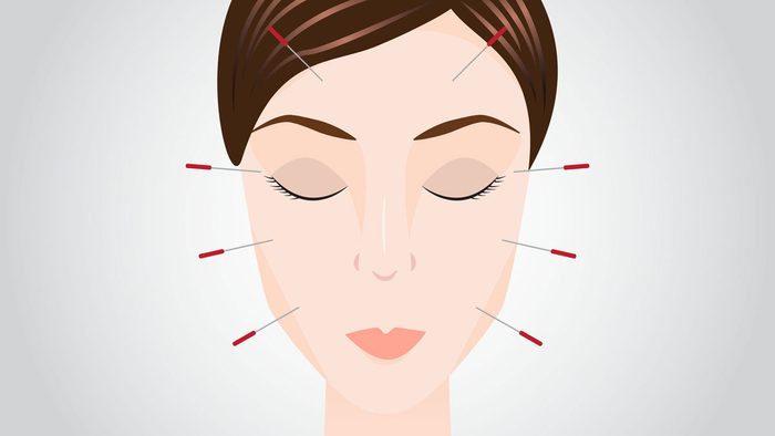 acupuncture for women's health
