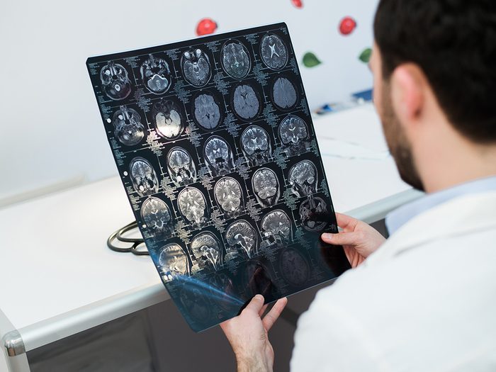 Health myth, a doctor checks brain scans