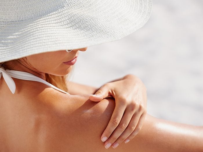 Eczema, woman applies sunscreen on her shoulder at the beach