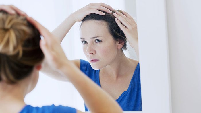 Itchy Scalp, woman looking at hair