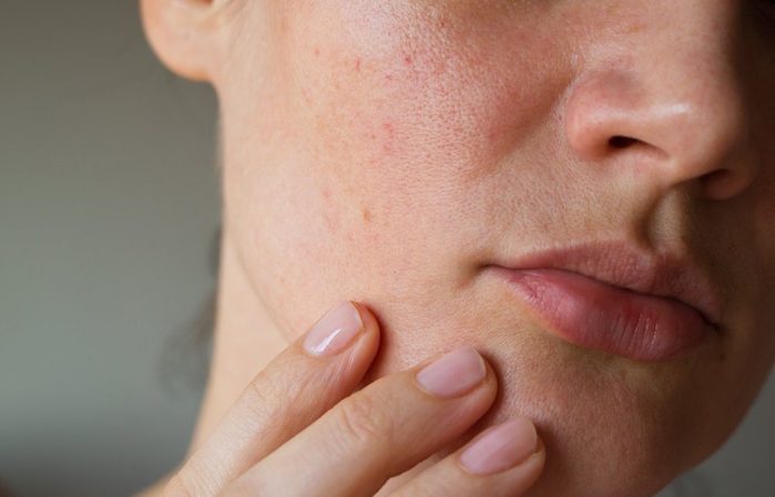 skin says about your health | pores on the skin of the face