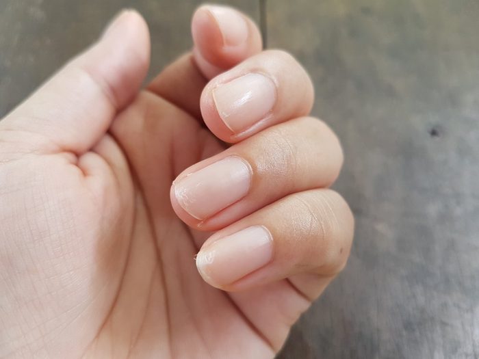 things that wreck your teeth | Close up of nails that have problem by peeling after doing manicure. Health and beauty problem. 
