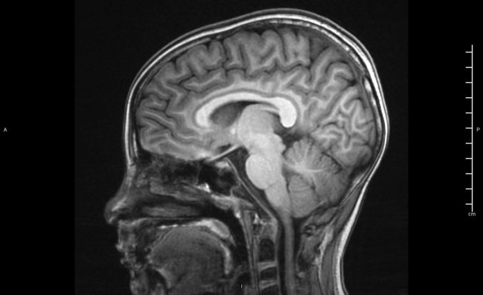 brain during sex