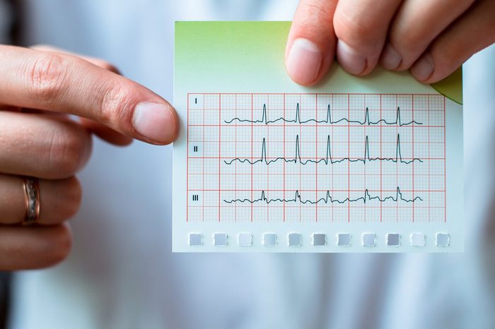 Electrocardiogram, ecg in hand, palm of a doctor. Medical health care. Clinic cardiology heart rhythm and pulse test closeup. Cardiogram printout. 