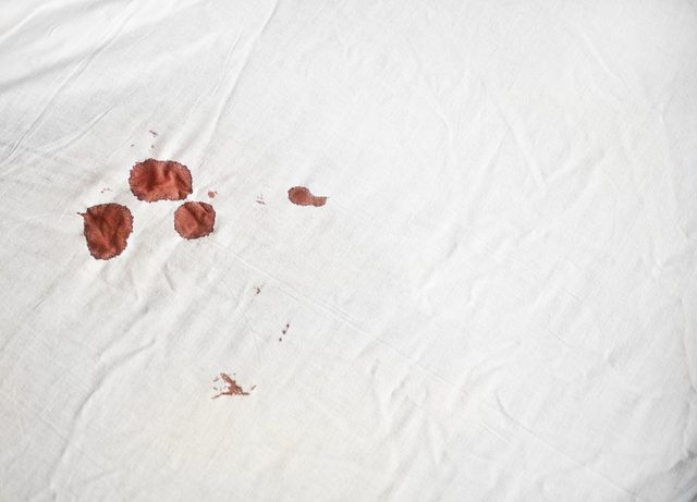 Bloodstains on a white sheet