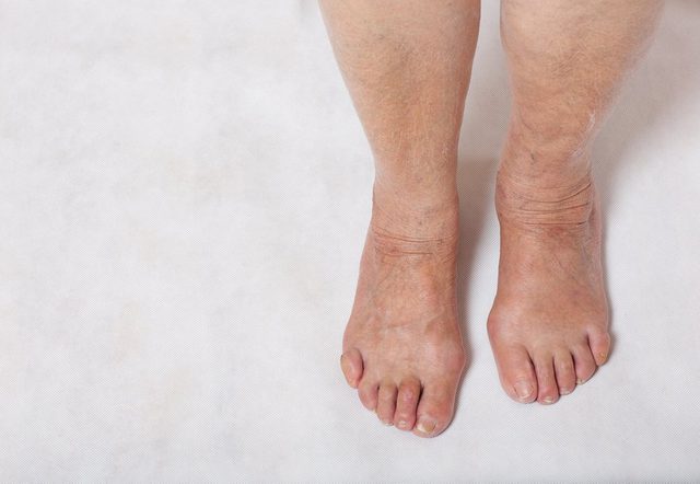 Feet of a senior woman between 70 and 80 years old