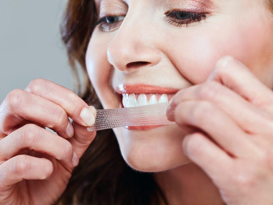 What Dentists Wish You Knew About Teeth Whitening | Best ...