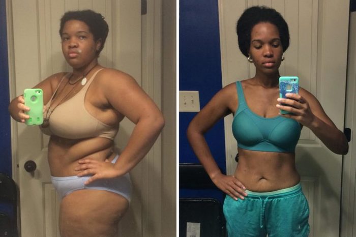 Weight Loss Before and After Photos
