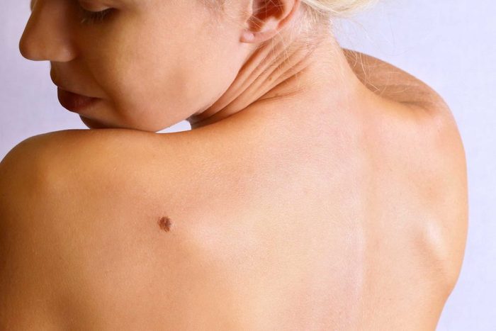 worst skin care advice skin cancer