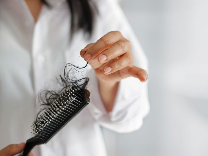 scalp psoriasis - hair on brush