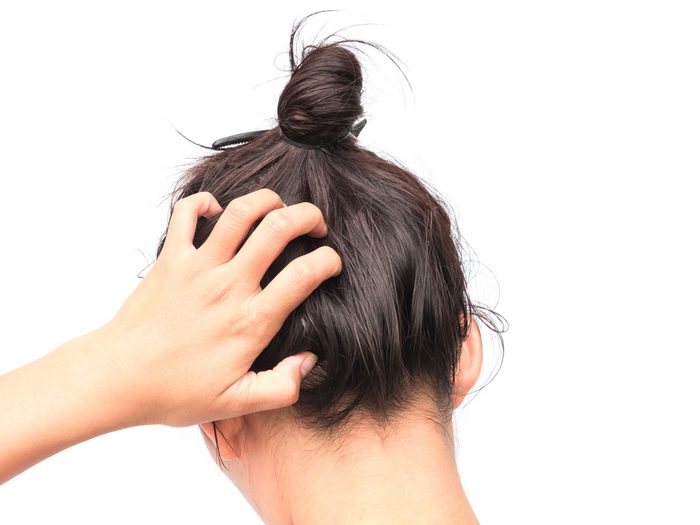 scalp psoriasis - woman itching scalp