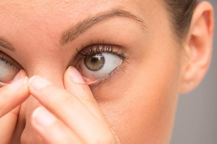 causes of dark under-eye circles