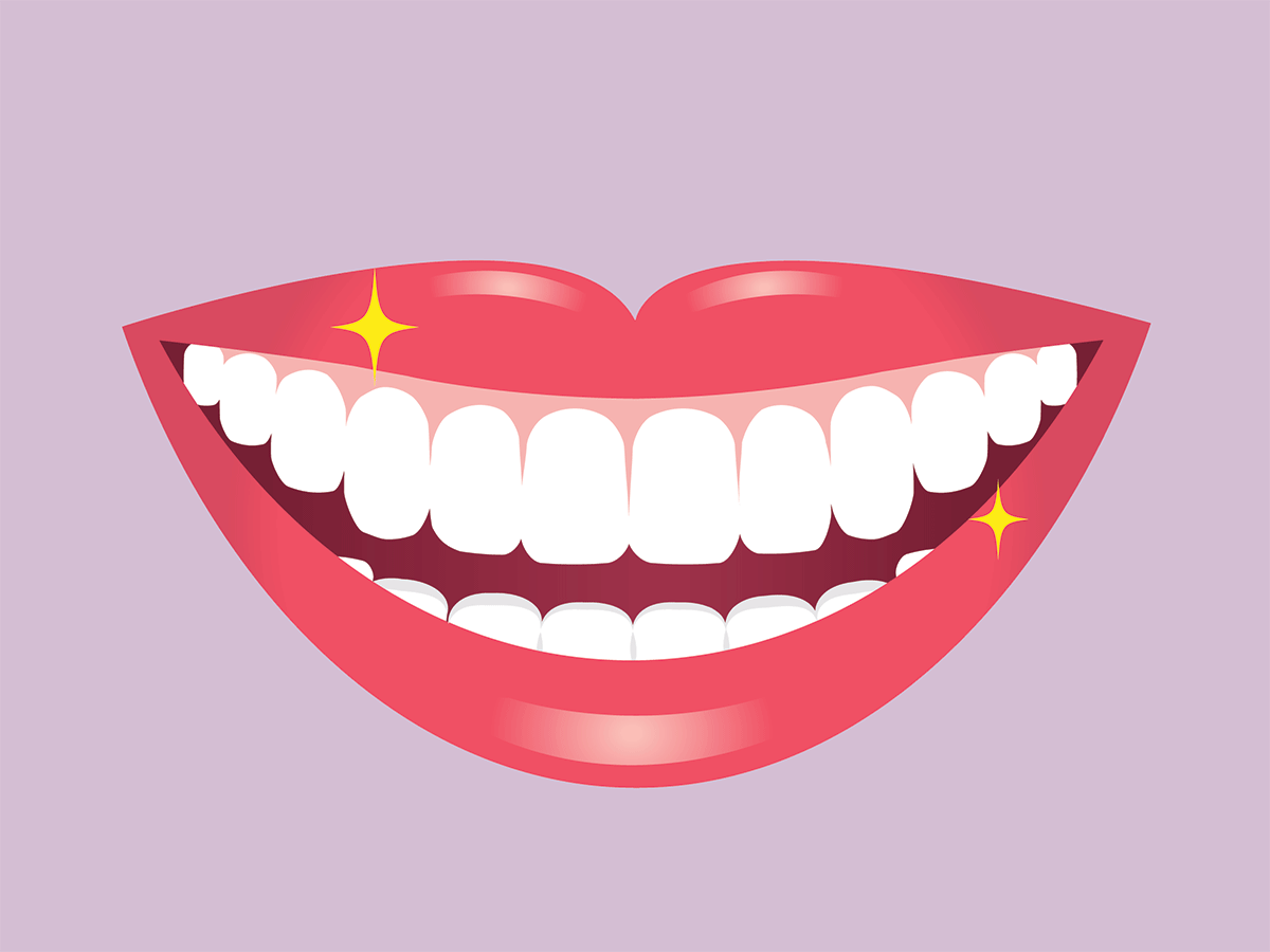 Teeth Whitening Mistakes