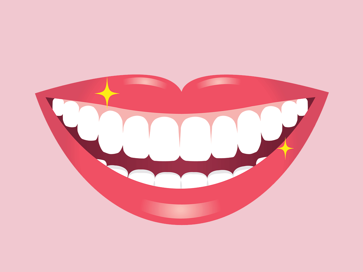 Teeth whitening mistakes, according to an expert