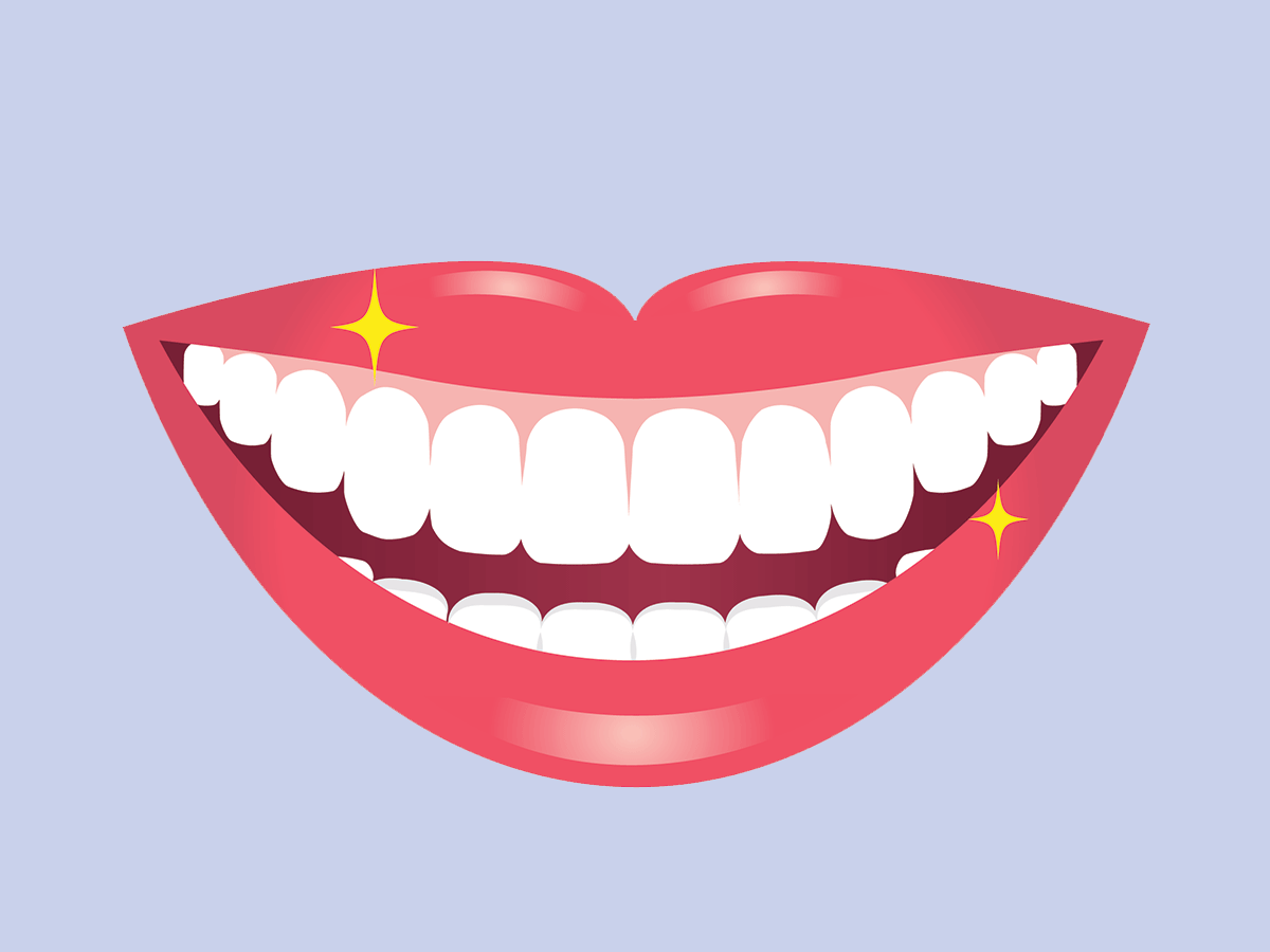Teeth whitening mistakes | Teeth whitening at a salon