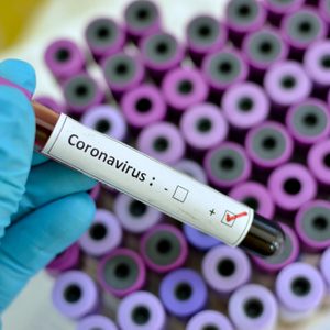 coronavirus blood sample diagnosis
