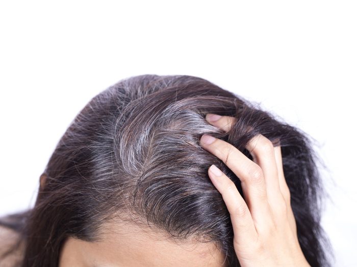what causes grey hair