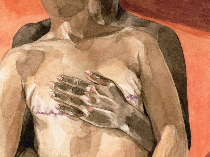 cancer sex life | sex after a cancer diagnosis | illustration of someone embracing their partner