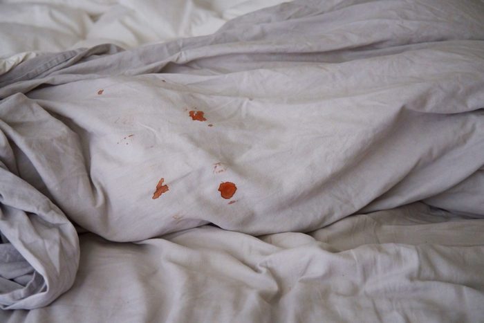 bleeding during sex | Blood Spots On Grey Linen Bedding