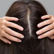 scalp serums | A,woman,is,massaging,her,scalp.