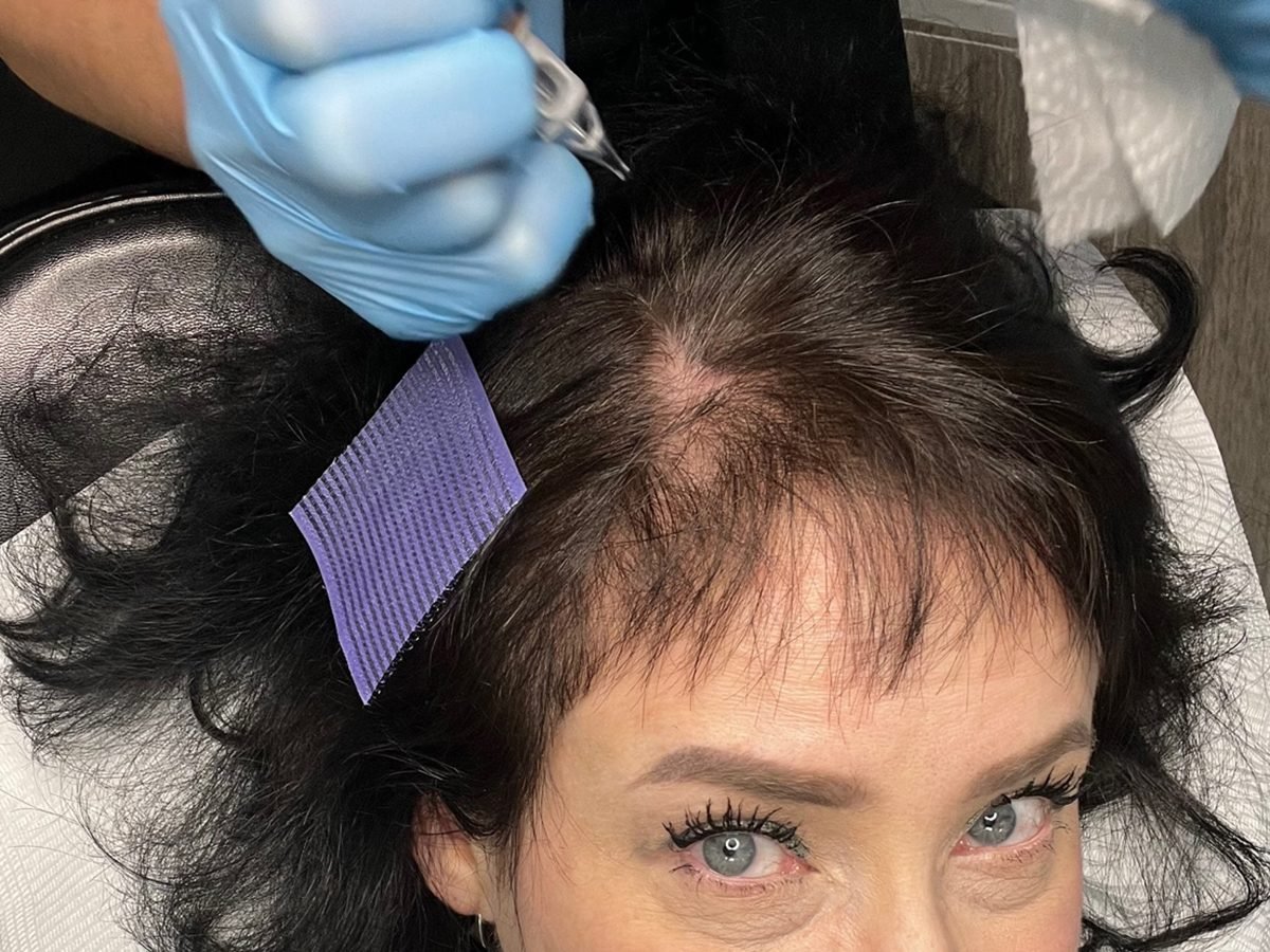 I'm Woman in Her Late 40s, and I Got a Hairline Tattoo