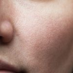 Is It Actually Possible to Shrink Large Pores? Experts Weigh In