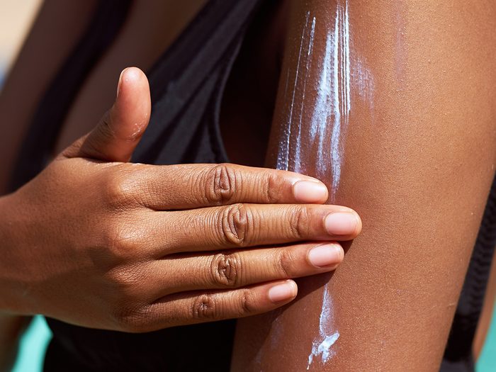dark skin cancer,Close,up,of,black,woman,spreading,sunscreen,onto,arm,with
