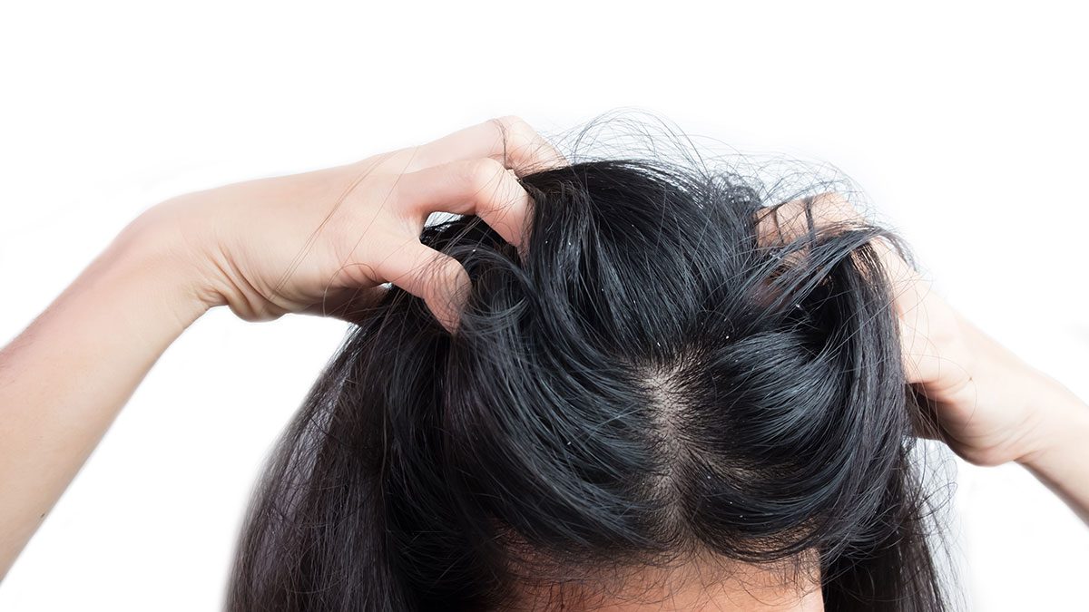 Photos Does Female Pattern Hair Loss Cause Itchy Scalp for Rounded Face